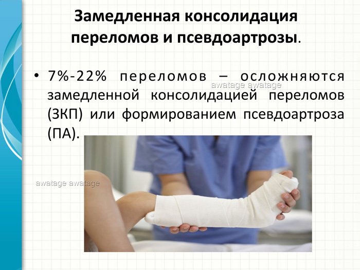 Замедленная консолидация переломов