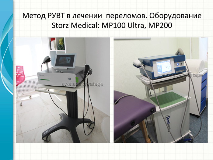 Для лечения пациентов c ЗКП использовались аппараты РУВТ Storz Medical