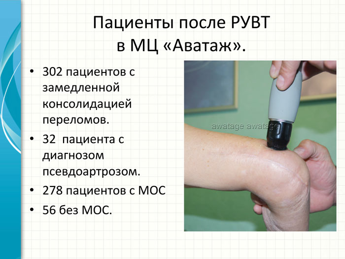 В работе представлены результаты лечения пациентов с замедленной консолидацией переломов методом РУВТ