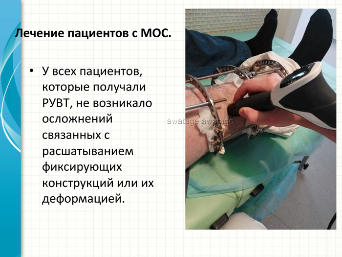 Металлические фиксирующие послеоперационные конструкции не являются противопоказанием для проведения ударно-волновой терапии.
